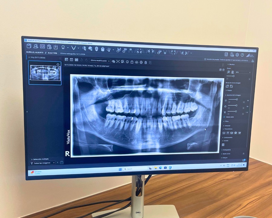 Radiografía panorámica tomada con el VistaVox en el software de Dürr Dental